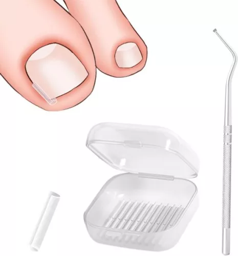 40 pieces of ingrown toenail smoothing strips with toenail lifter for correction of ingrown toenails